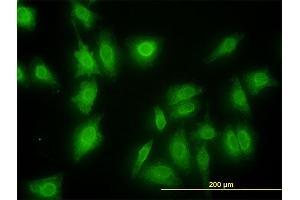 Immunofluorescence of monoclonal antibody to MKNK1 on HeLa cell. (MKNK1 antibody  (AA 1-465))