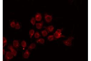 ABIN6272242 staining Hela by IF/ICC. (APOBEC3A antibody)