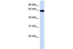 Image no. 1 for anti-Hypermethylated in Cancer 2 (HIC2) (AA 395-444) antibody (ABIN6742231) (HIC2 antibody  (AA 395-444))