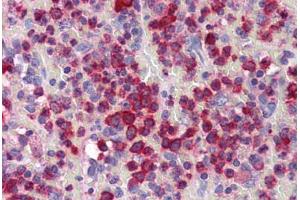 Human Spleen (formalin-fixed, paraffin-embedded) stained with GZMB antibody ABIN351505 at 10 ug/ml followed by biotinylated goat anti-rabbit IgG secondary antibody ABIN481713, alkaline phosphatase-streptavidin and chromogen. (GZMB antibody  (N-Term))