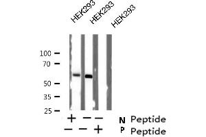 Western blot analysis of LCK (Phospho-Ser59) expression in HEK293 lysate (LCK antibody  (pSer59))