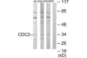 Western Blotting (WB) image for anti-Cyclin-Dependent Kinase 1 (CDK1) (Internal Region) antibody (ABIN1849110) (CDK1 antibody  (Internal Region))