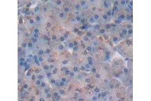 IHC-P analysis of Human Tissue, with DAB staining. (STATH antibody  (AA 1-62))