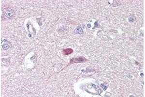 Anti-GRM4 / MGLUR4 antibody IHC staining of human brain, cortex. (Metabotropic Glutamate Receptor 4 antibody  (AA 851-900))