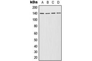 Western blot analysis of INCENP expression in Jurkat (A), Molt4 (B), SP2/0 (C), PC12 (D) whole cell lysates. (INCENP antibody  (Center))