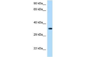 WB Suggested Anti-March2 Antibody Titration: 1. (MARCH2 antibody  (Middle Region))