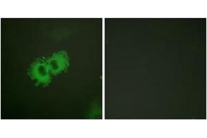 Immunofluorescence analysis of HeLa cells, using Caldesmon (Phospho-Ser789) Antibody. (Caldesmon antibody  (pSer789))