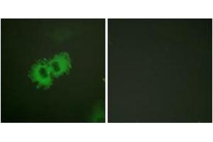 Immunofluorescence analysis of HeLa cells, using Caldesmon (Phospho-Ser789) Antibody. (Caldesmon antibody  (pSer789))