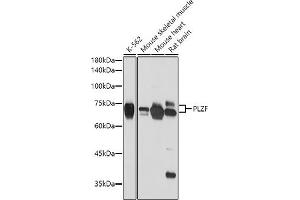 Western blot analysis of extracts of various cell lines, using PLZF antibody (ABIN6128472, ABIN6150368, ABIN6150369 and ABIN6221570) at 1:2654 dilution.
