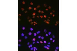 Immunofluorescence analysis of NIH-3T3 cells using mSin3A Rabbit mAb (ABIN7270318) at dilution of 1:100 (40x lens). (SIN3A antibody)