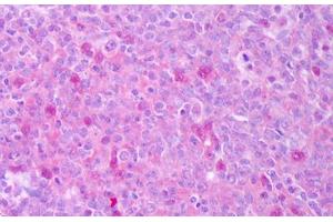 Anti-CD40LG / CD54 antibody IHC staining of human tonsil. (CD40 Ligand antibody)