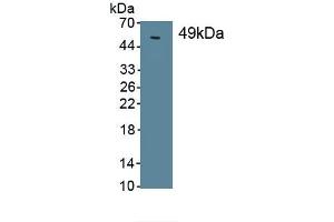 Detection of Recombinant SPC, Human using Monoclonal Antibody to Surfactant Protein C (SP-C) (Surfactant Protein C antibody  (AA 24-197))