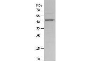 Western Blotting (WB) image for ATG7 Autophagy Related 7 (ATG7) (AA 410-619) protein (His-IF2DI Tag) (ABIN7284059) (ATG7 Protein (AA 410-619) (His-IF2DI Tag))