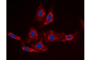 Immunofluorescent analysis of Beta-catenin (pS33) staining in HepG2 cells. (beta Catenin antibody  (N-Term, pSer33))