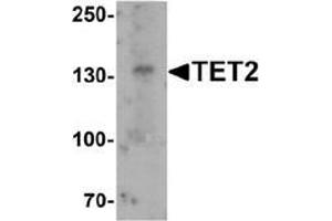 Western blot analysis of TET2 in SK-N-SH cell lysate with TET2 antibody at 1 µg/ml. (TET2 antibody  (N-Term))