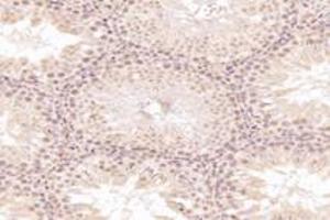 Immunohistochemistry analysis of paraffin-embedded rat testis using,MED3 (ABIN7074581) at dilution of 1: 7200 (MED27 antibody)