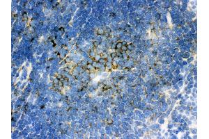 Anti- SQSTM1 Picoband antibody,IHC(F) IHC(F): Mouse Spleen Tissue (SQSTM1 antibody  (N-Term))