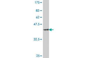 Western Blot detection against Immunogen (39. (TLR5 antibody  (AA 517-634))