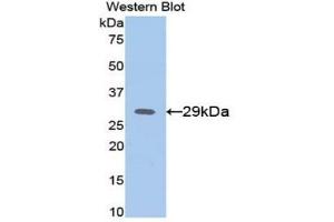 Detection of Recombinant AFP, Mouse using Polyclonal Antibody to Alpha-Fetoprotein (AFP)