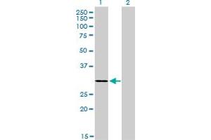 Western Blot analysis of LDB3 expression in transfected 293T cell line by LDB3 monoclonal antibody (M06), clone 3C8. (LIM Domain Binding 3 Protein antibody  (AA 1-283))