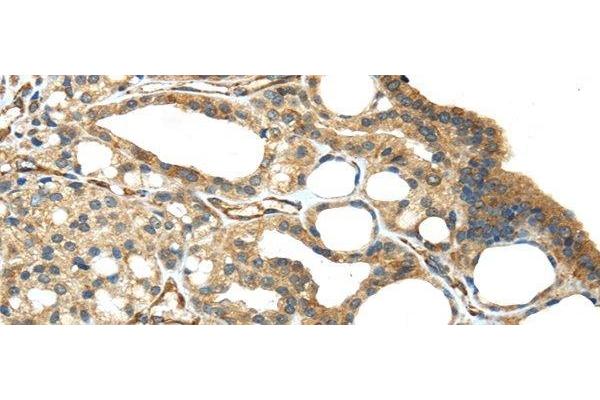 Isthmin 2 antibody