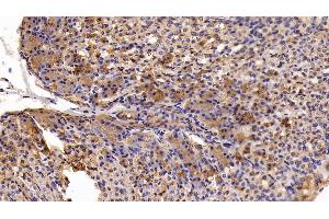 Immunohistochemistry (IHC) image for anti-Mannan-Binding Lectin Serine Peptidase 1 (MASP1) (AA 25-453) antibody (ABIN7434302)