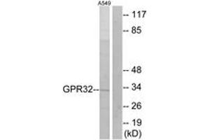 Western blot analysis of extracts from A549 cells, using GPR32 Antibody. (GPR32 antibody  (AA 151-200))