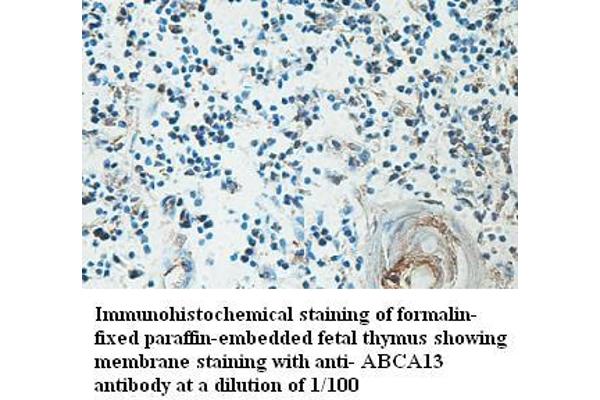 ABCA13 antibody