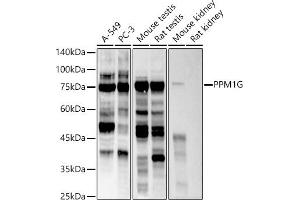 Western blot analysis of extracts of various cell lines, using PPM1G antibody (ABIN7269696) at 1:500 dilution. (PPM1G antibody)