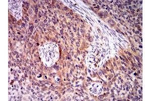 Immunohistochemistry (IHC) image for anti-Bridging Integrator 1 (BIN1) (AA 189-398) antibody (ABIN5542282)