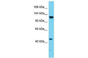 Host: Rabbit Target Name: EFTUD1 Sample Type: HepG2 Whole Cell lysates Antibody Dilution: 1. (EFTUD1 antibody  (N-Term))