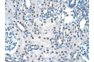 YWHAQ antibody was used for immunohistochemistry at a concentration of 4-8 ug/ml to stain Epithelial cells of renal tubule (arrows) in Human Kidney. (14-3-3 theta antibody  (N-Term))