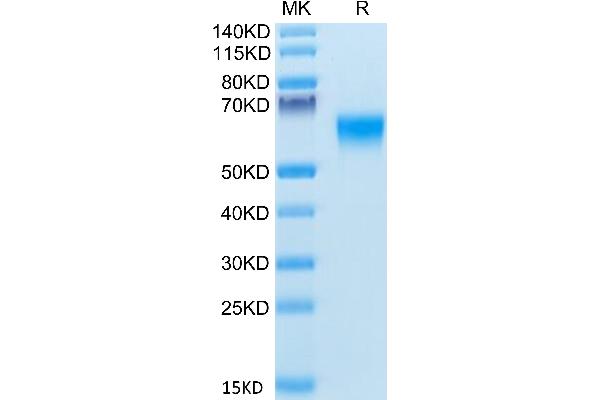 BACE1 Protein (AA 22-457) (His tag)