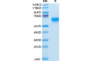 Human BACE-1 on Tris-Bis PAGE under reduced condition. (BACE1 Protein (AA 22-457) (His tag))