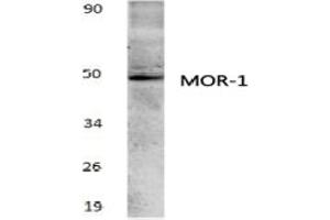 Image no. 1 for anti-Opioid Receptor, mu 1 (OPRM1) antibody (ABIN317766) (Mu Opioid Receptor 1 antibody)