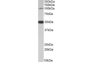 Western Blotting (WB) image for anti-Patched Domain Containing 1 (PTCHD1) antibody (ABIN5937394)