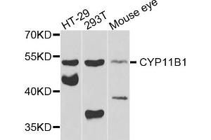 Western blot analysis of extracts of various cells, using CYP11B1 antibody.