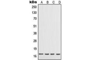 Western blot analysis of IL-17 expression in A20 (A), THP1 (B), Raw264. (IL-17 antibody  (Center))