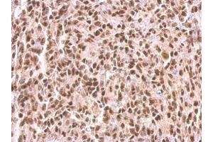 IHC-P Image MEF2C antibody detects MEF2C protein at nucleus on Saos2 xenograft by immunohistochemical analysis. (MEF2C antibody)