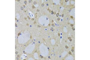 Immunohistochemistry of paraffin-embedded mouse brain using YWHAZ antibody. (14-3-3 zeta antibody)