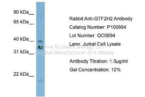 Western Blotting (WB) image for anti-General Transcription Factor IIH, Polypeptide 2, 44kDa (GTF2H2) (C-Term) antibody (ABIN2792641) (GTF2H2 antibody  (C-Term))