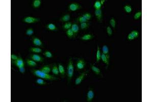 Immunofluorescent analysis of Hela cells using ABIN7151326 at dilution of 1:100 and Alexa Fluor 488-congugated AffiniPure Goat Anti-Rabbit IgG(H+L) (EEA1 antibody  (AA 734-875))