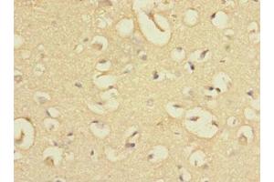 Immunohistochemistry of paraffin-embedded human brain tissue using ABIN7165334 at dilution of 1:100