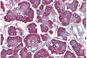Human Pancreas: Formalin-Fixed, Paraffin-Embedded (FFPE) (PDCD5 antibody  (C-Term))