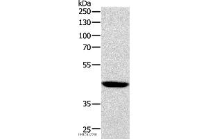 Western blot analysis of Human lymphoma tissue, using SOX7 Polyclonal Antibody at dilution of 1:1100 (SOX7 antibody)