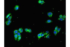 Immunofluorescent analysis of HepG2 cells using ABIN7154727 at dilution of 1:100 and Alexa Fluor 488-congugated AffiniPure Goat Anti-Rabbit IgG(H+L) (GNA11 antibody  (AA 1-359))