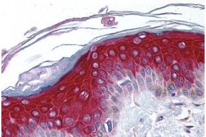 Human Skin (formalin-fixed, paraffin-embedded) stained with RPS6KA1 antibody ABIN213975 at 5 ug/ml followed by biotinylated goat anti-rabbit IgG secondary antibody ABIN481713, alkaline phosphatase-streptavidin and chromogen.
