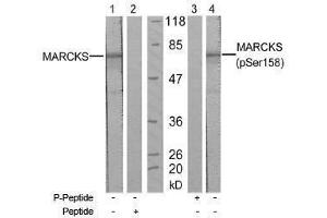 Image no. 1 for anti-Myristoylated Alanine-Rich Protein Kinase C Substrate (MARCKS) (pSer158) antibody (ABIN197064) (MARCKS antibody  (pSer158))
