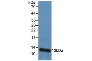 Detection of b2M in Human Urine Tissue using Polyclonal Antibody to Beta-2-Microglobulin (b2M) (beta-2 Microglobulin antibody  (AA 1-125))
