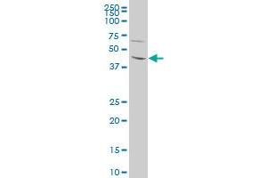 LHX1 polyclonal antibody (A01), Lot # O60501JCS1 Western Blot analysis of LHX1 expression in 293 . (LHX1 antibody  (AA 1-100))